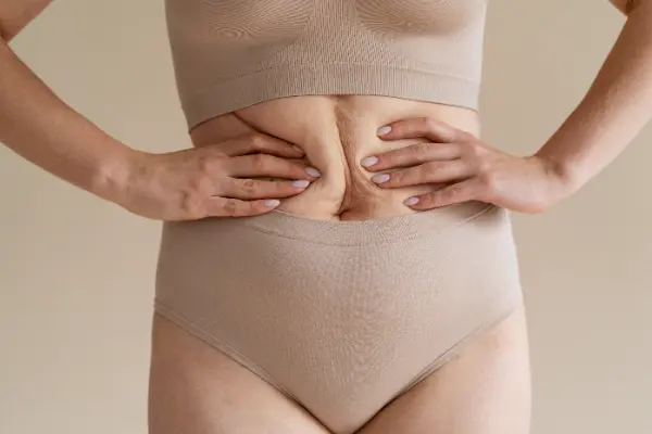 Si ha considerado una lipoescultura, es fundamental entender por qué se puede producir fibrosis después de una lipo​. Este proceso natural del cuerpo puede afectar la textura y apariencia de...